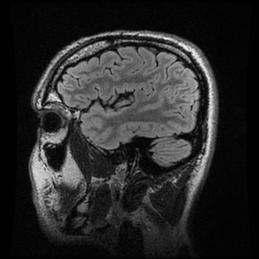 Brain