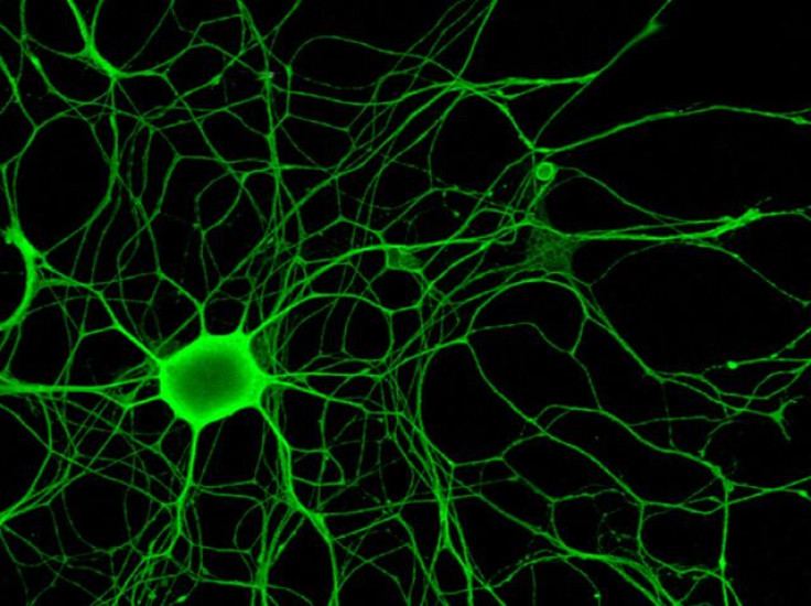 Neurons nerves