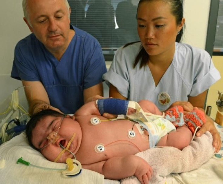Jasleen, Germany's Largest Baby On Record 