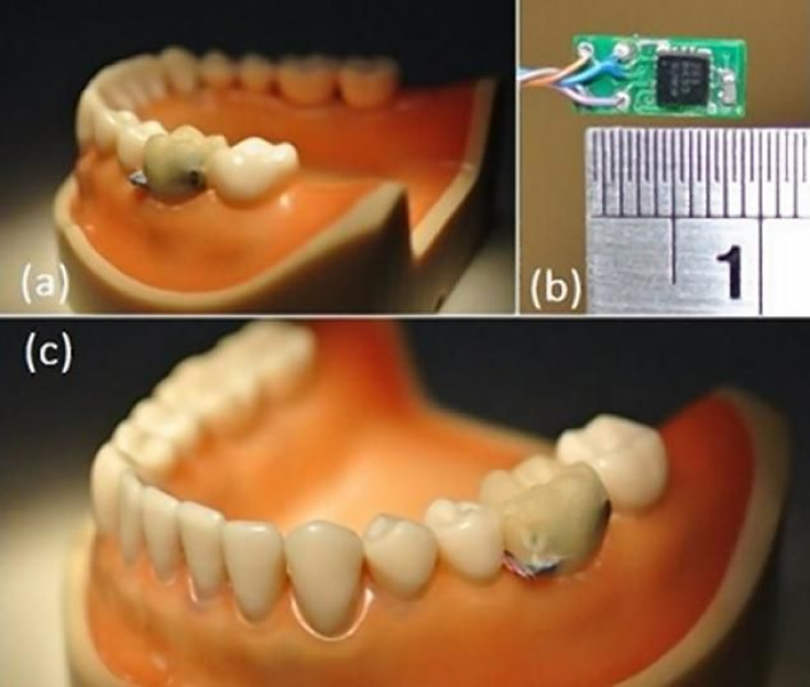 tooth sensor