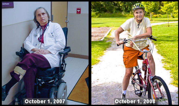 Terry Wahls Before And After MS Diet