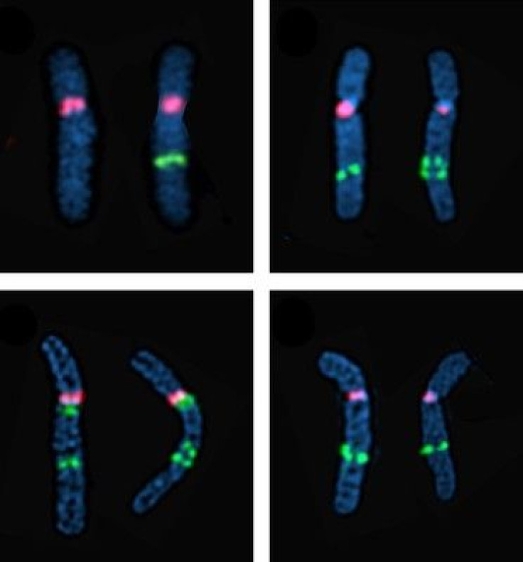 Clone of autism chromosomes