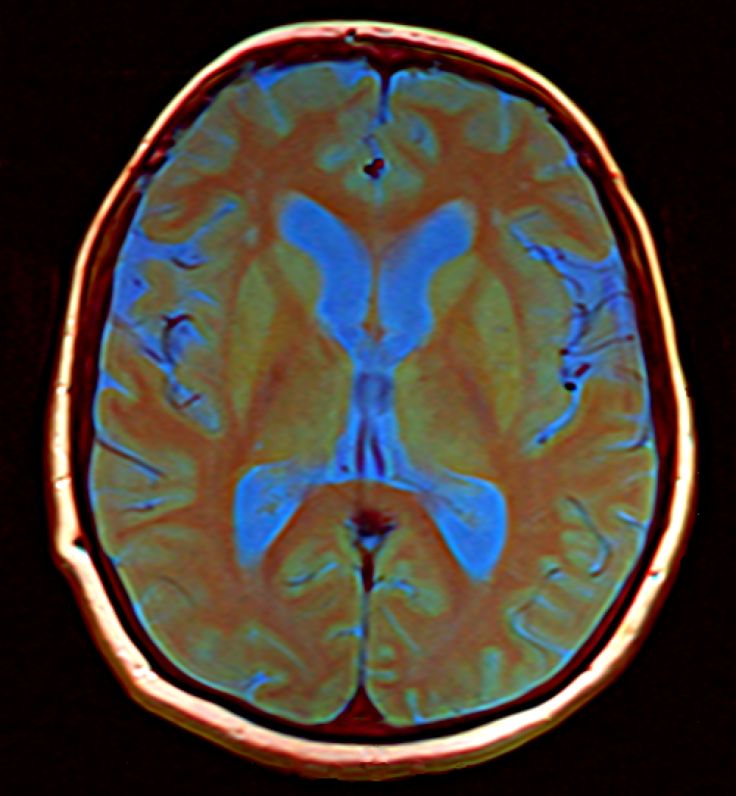 Brain MRI