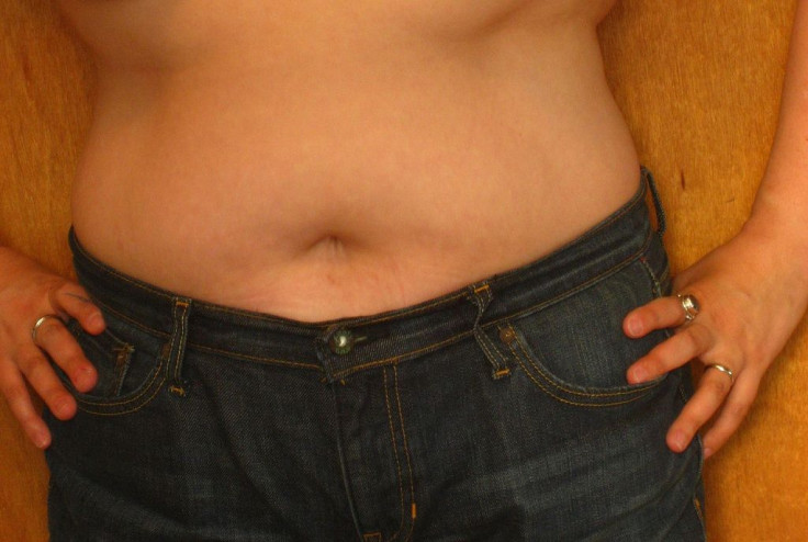 abdomen fat