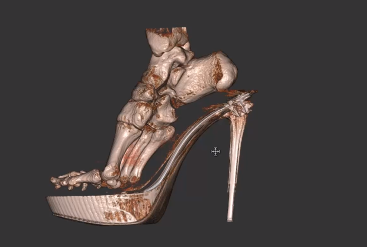 High heel scan