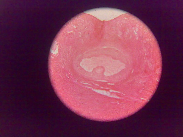 Ovary Histology