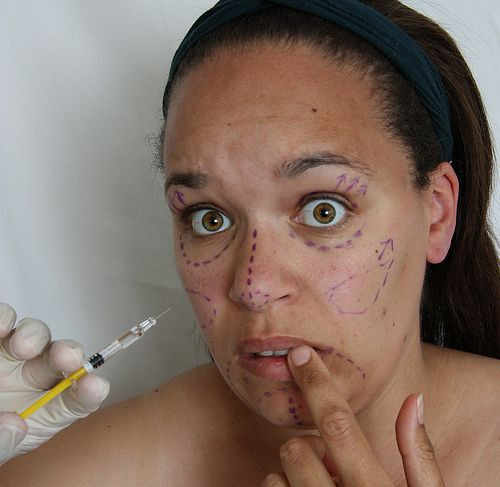 botox
