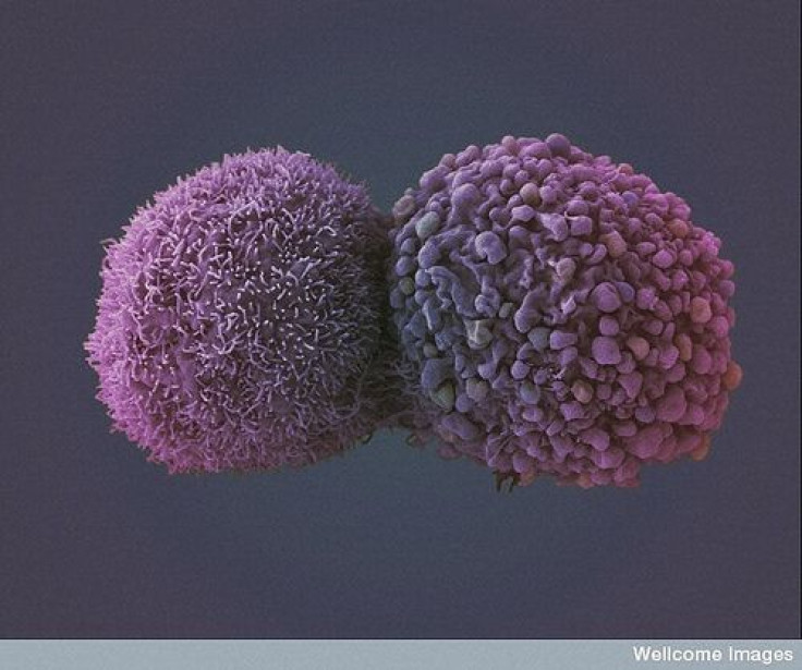 lungcancercells