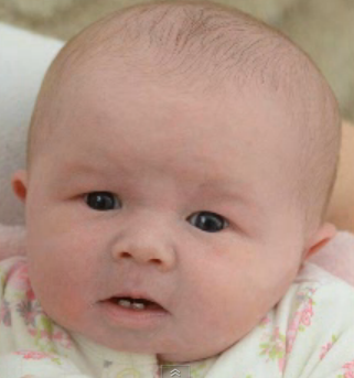Eva Faith, newborn born with two front teeth