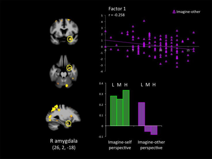 Psychopaths Feel Only Their Own Pain