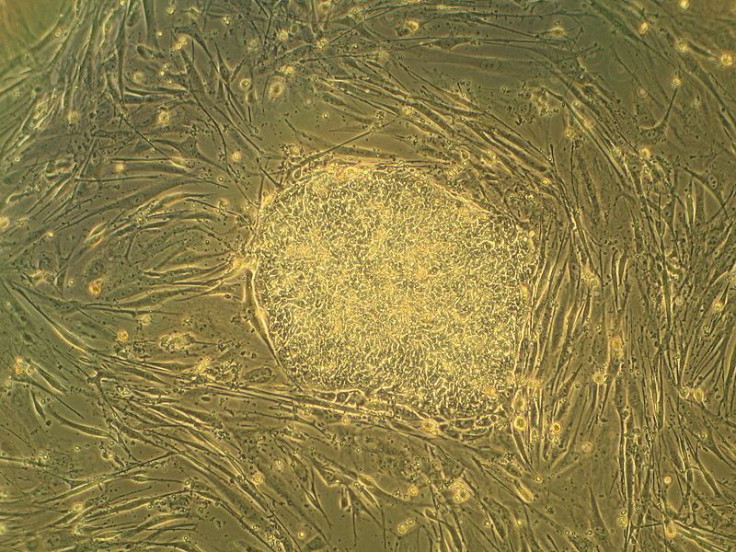 Human stem cell