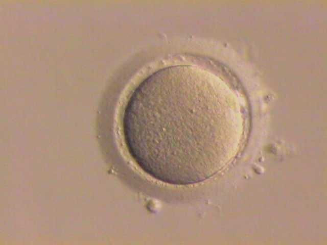 chromosomes forming within maturing oocyte