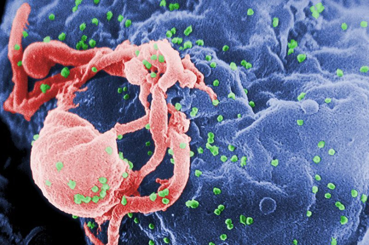 an electronic microscope image of HIV