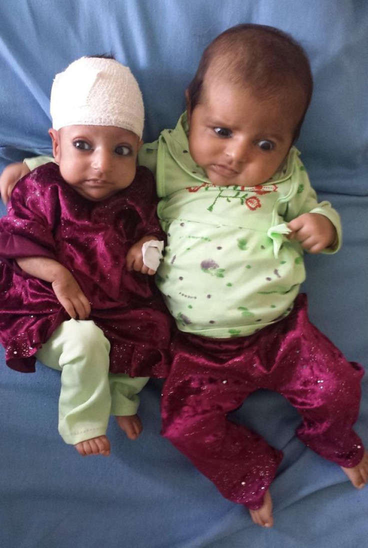 Three-month-old-Asree-Gul-and-her-twin-sister-at-a-hospital-in-the-eastern-Afghanistan-city-of-Jalalabad-2306347