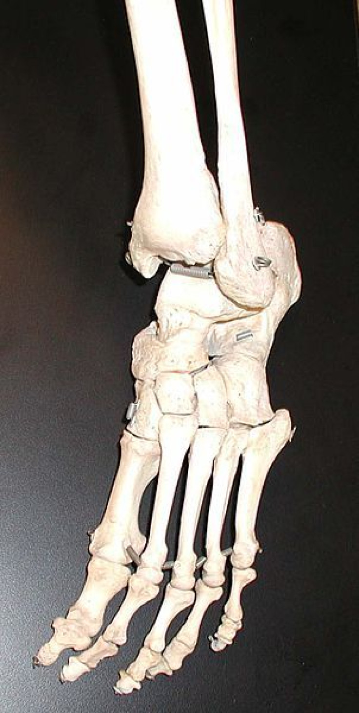 Bones in a human foot