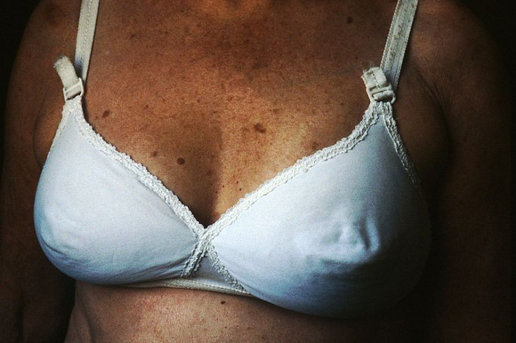800px-Breast_reconstruction_(4)