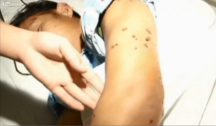 Patients In China