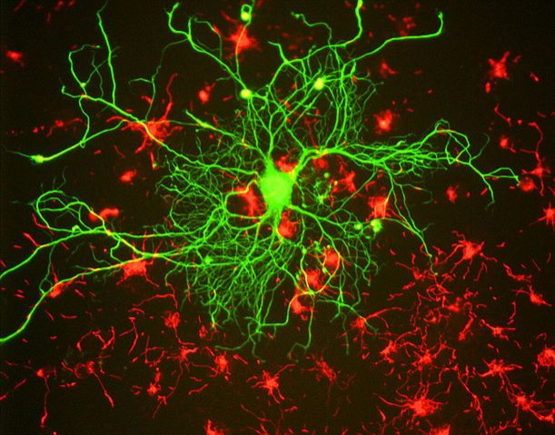 Neuron in tissue culture