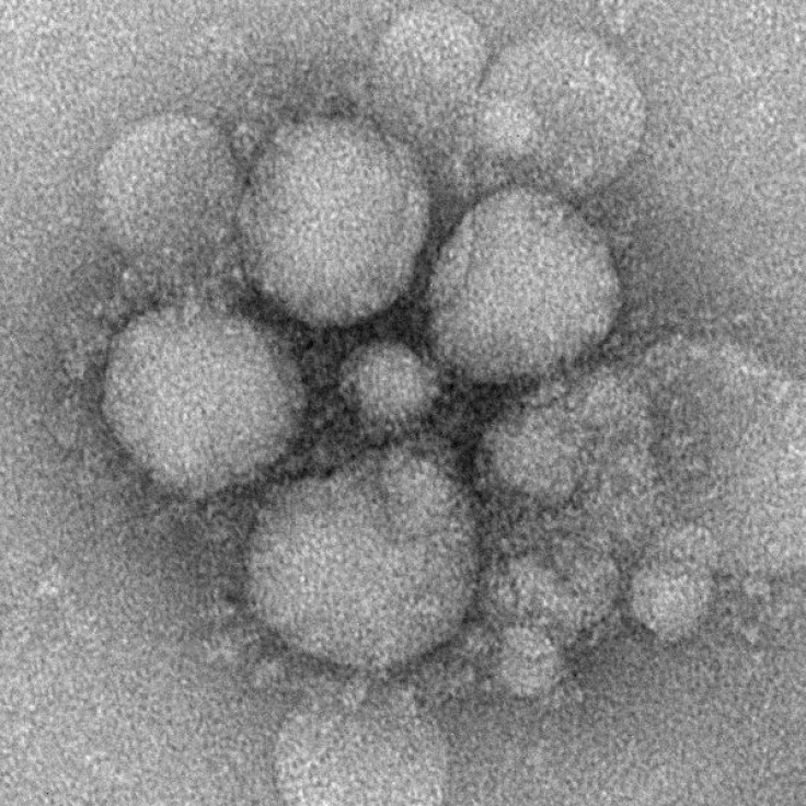 Electron microscope view of MERS coronavirus
