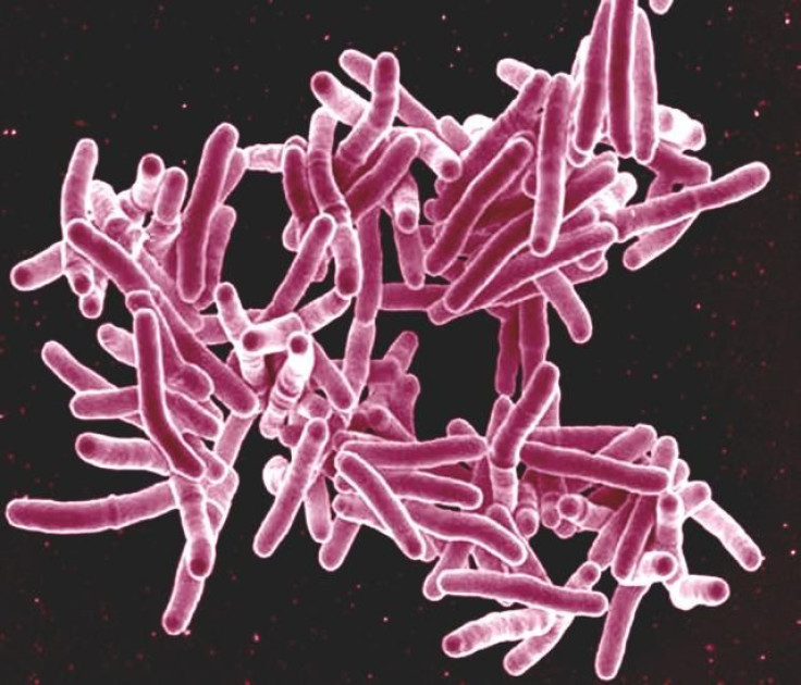 Image of Bacteria