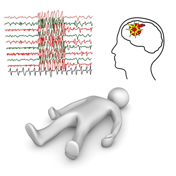 Cannibidiol May Provide Anti-Seizure Relief