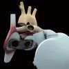 Photo of Carmat prosthetic heart