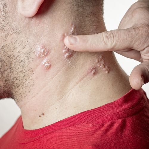 shutterstock_134601161
