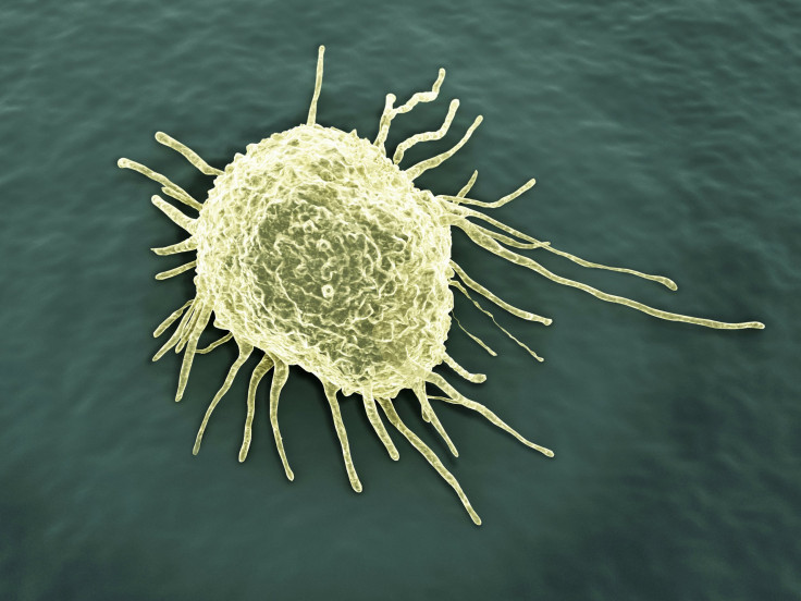 Cancer cell via Shutterstock