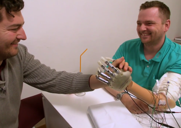 bionic hand