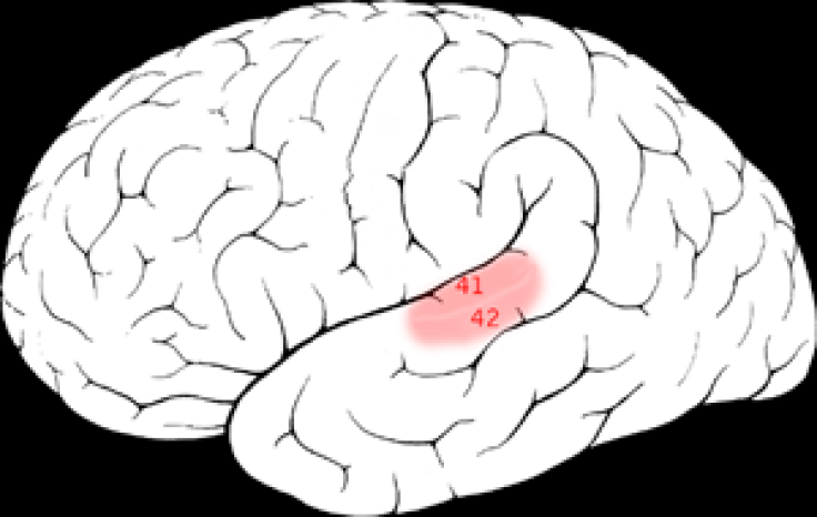 brain auditory cortex