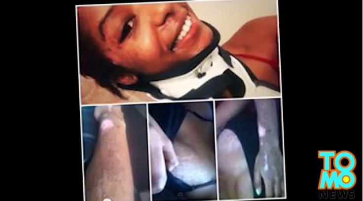 Teen Beaten Up