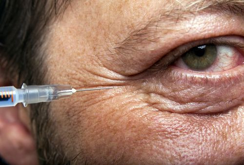 Man getting treatment with botox hyaluronic collagen HA injection