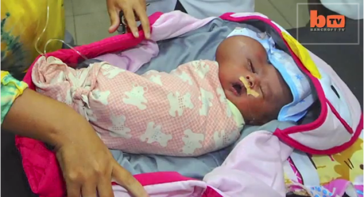 Baby born with "heart-shaped head" has growing tumor on the side of his face