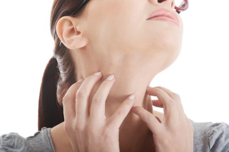 Woman scratching neck with fingernails 