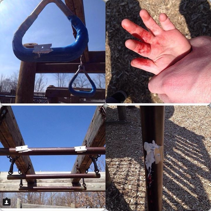 Razor Blades in Playgrounds