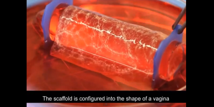 Lab Grown Vagina