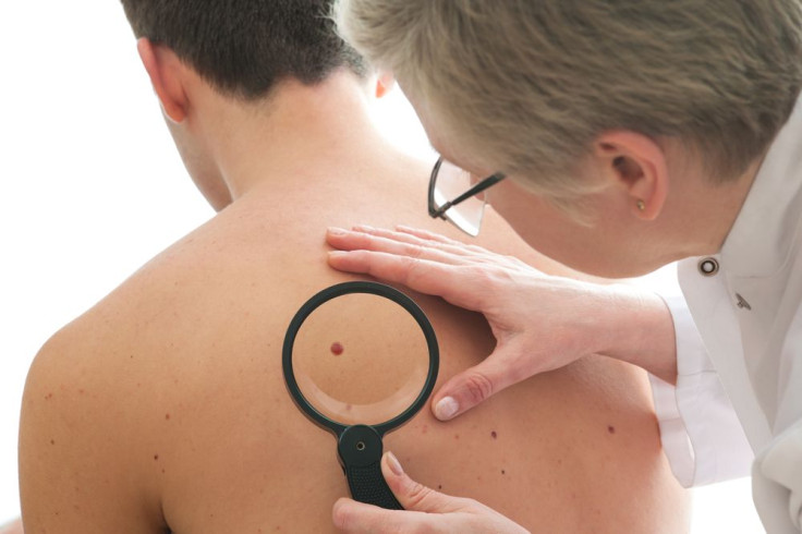 Skin Cancer Rates