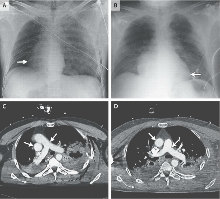 New England Journal of Medicine 