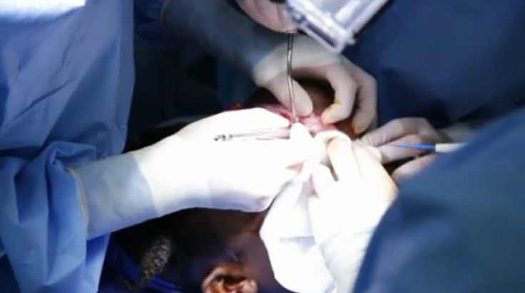 Doctors perform surgery