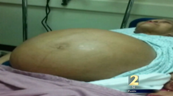 Woman with tumor on hospital bed