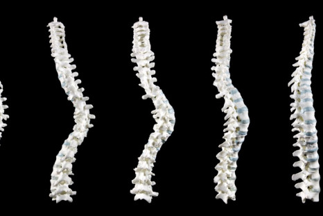 Researchers at the University of Leicester have created a rotating, 3D picture of King Richard III's spiral-shaped spine.