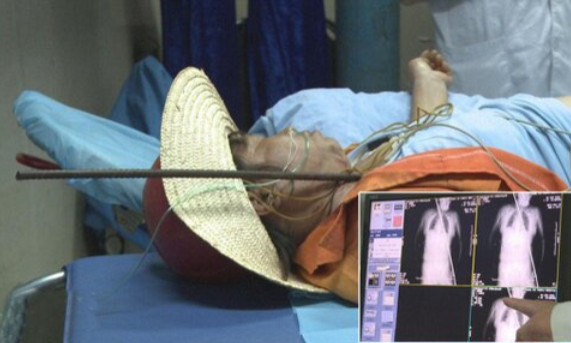 Chinese woman has steel rod pierce through body