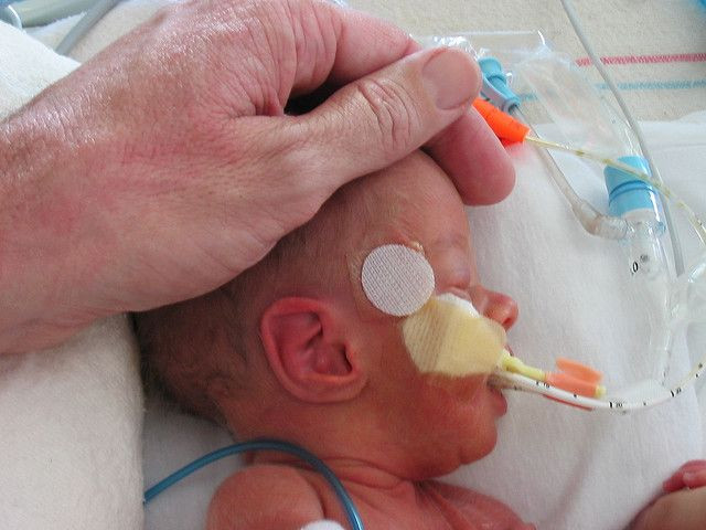 preemie