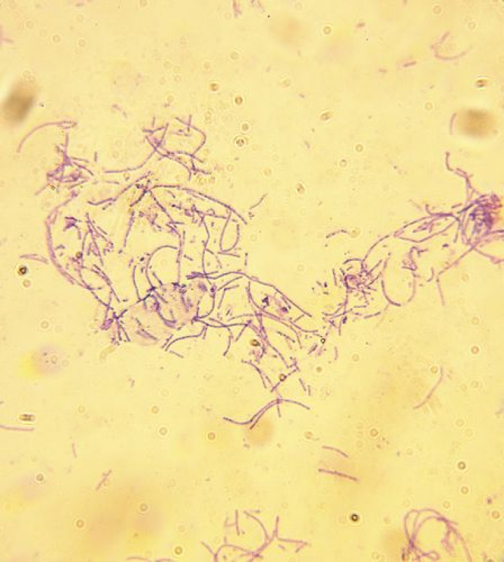 anthrax spores