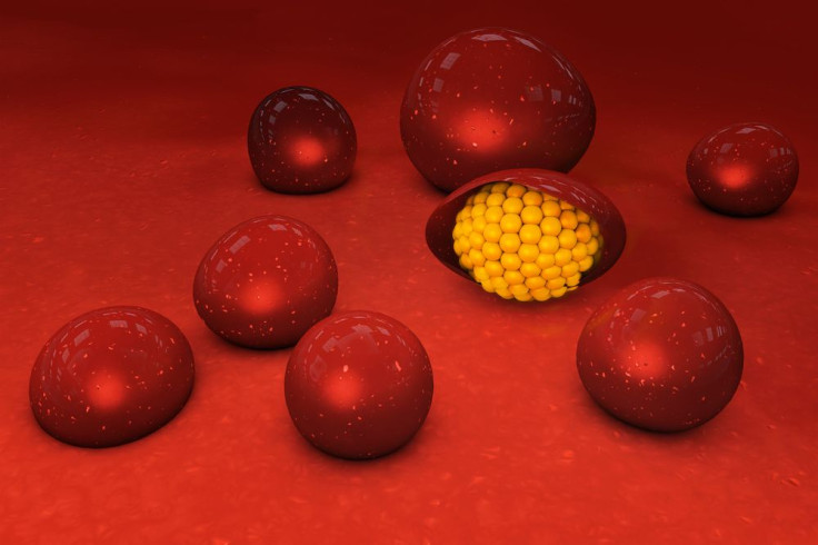 Malaria