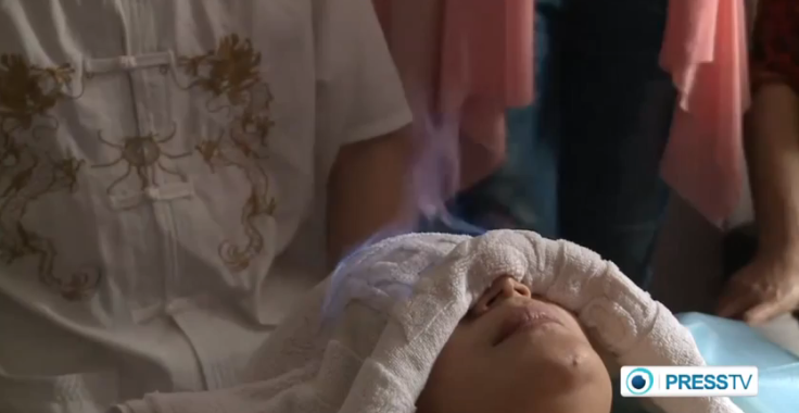 Fenghao performs fire therapy on patient