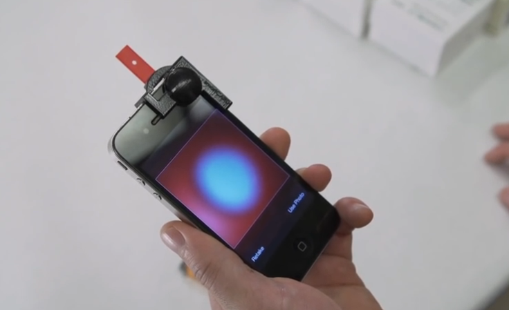 Smartphone device reads cholesterol and vitamin D levels with a selfie