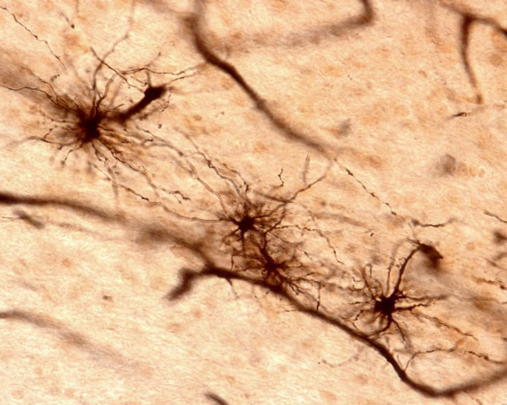 Astrocytes