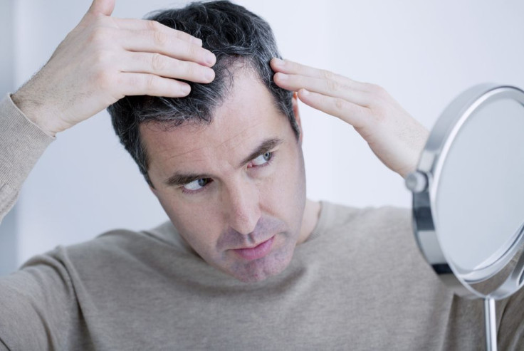 Hair Loss Myths