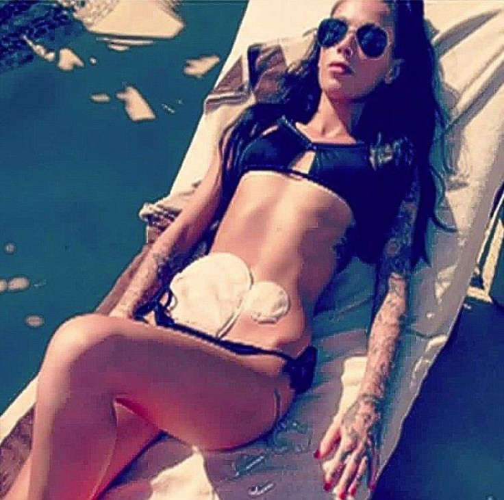 Bethany Townsend Colostomy Bikini Photo, Caters News Agency